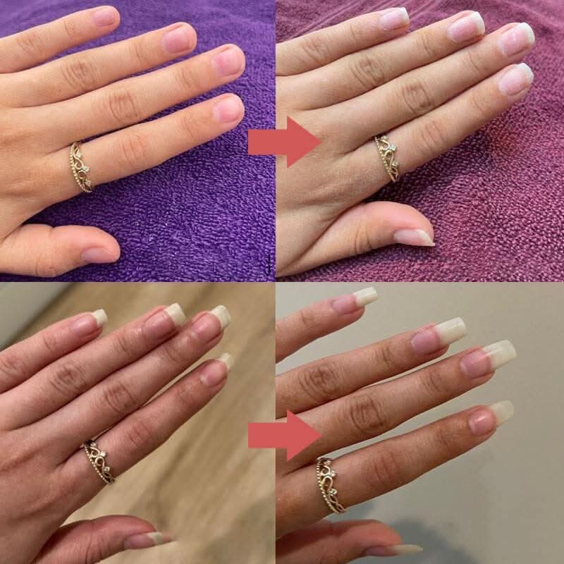 Närande penna för nagelband och torra naglar 